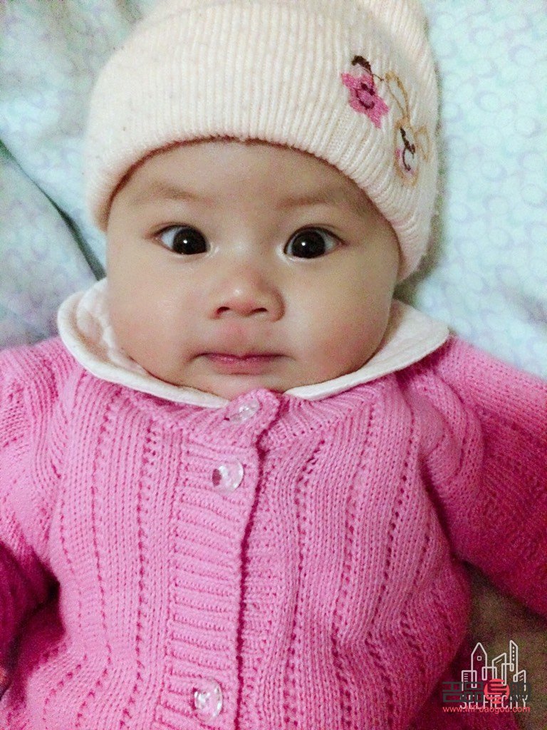 <h3>宝宝内双眼皮是否会自然变为外双眼皮？</h3>