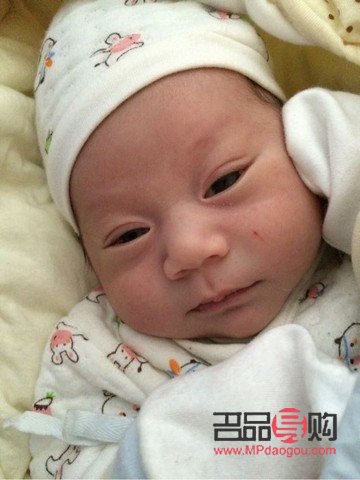 宝宝内双眼皮是否会自然变为外双眼皮？