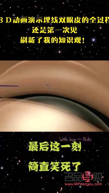 3d演示割双眼皮(3d演示割双眼皮视频)