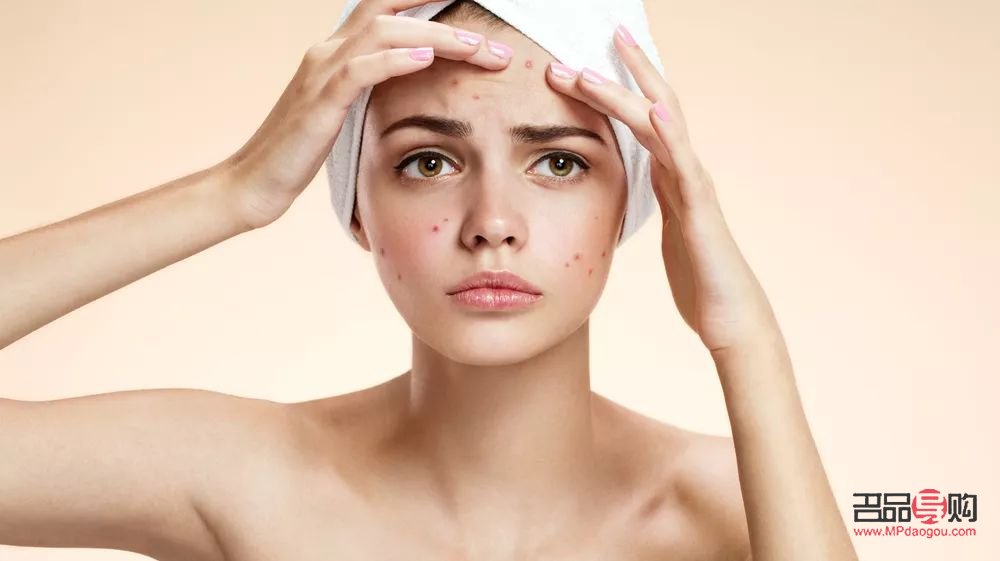 去美容院清痘好吗(去美容院清痘好吗女生)