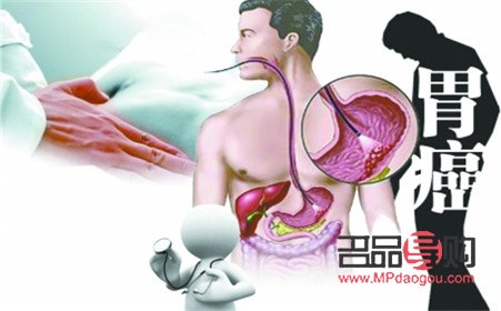 怎么护理癌症患儿身体(怎么护理癌症患儿身体健康)