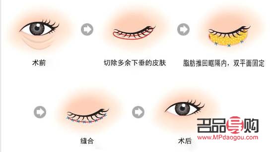 眼综合是指哪些项目(眼综合是指什么) 眼综合是指哪些项目(眼综合是指什么)