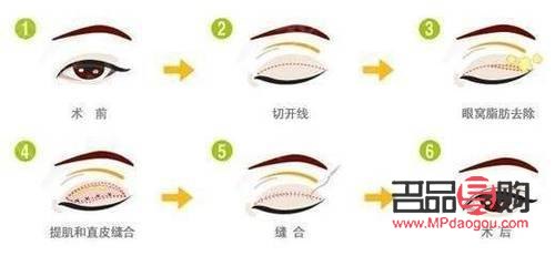 眼综合是指哪些项目(眼综合是指什么)