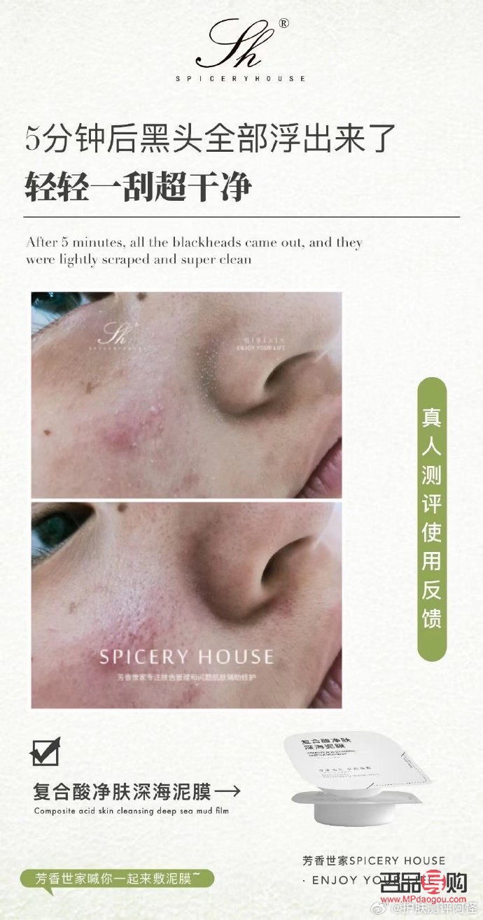 <h3>身体刷酸后的护理之道</h3>