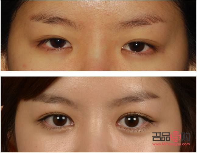 怎样能让内双眼皮变外双眼皮视频(怎样能让内双眼皮变外双眼皮视频讲解)