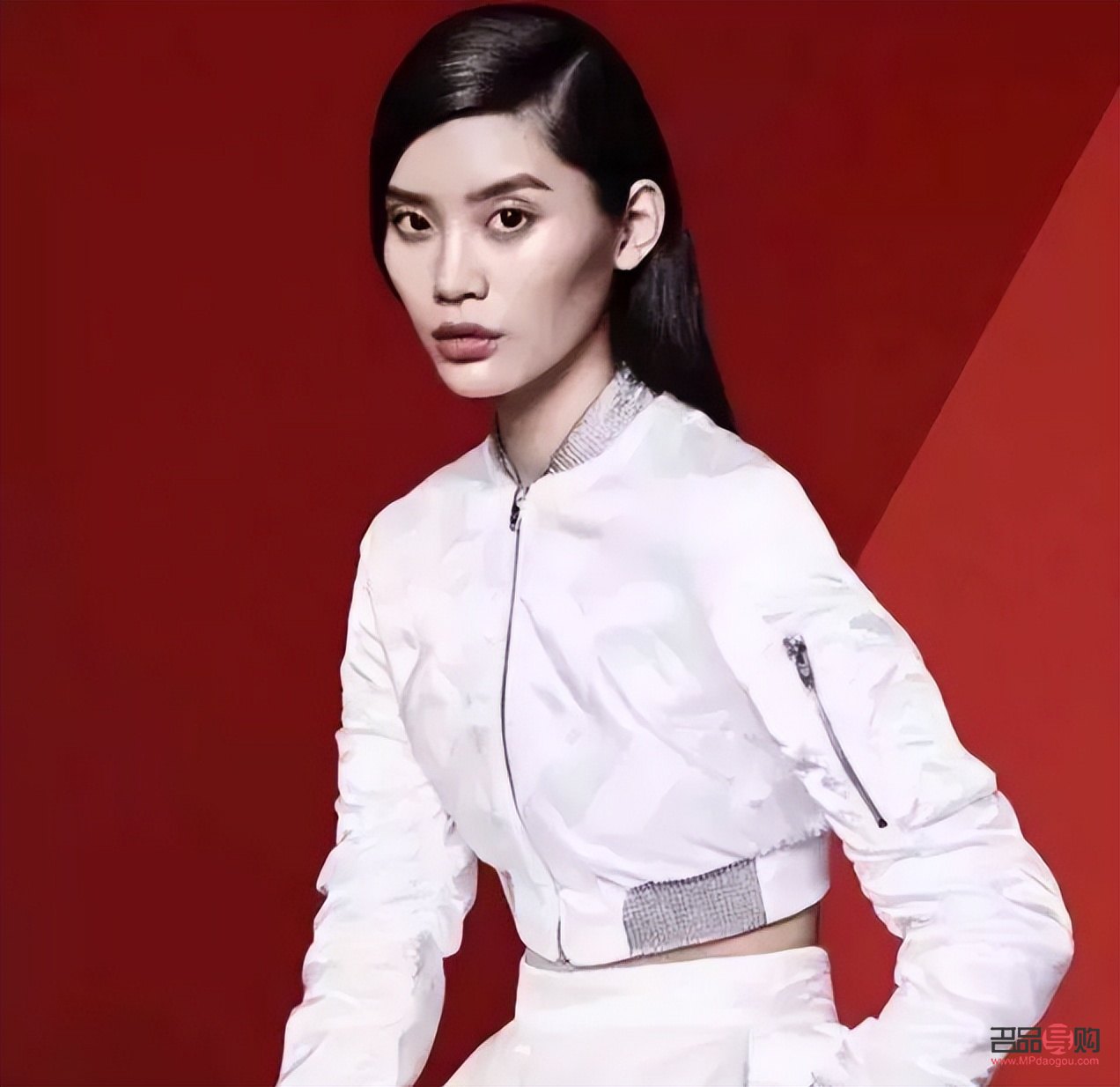 眼窝填充术大概要多少钱(眼窝脂肪填充第3天照片) 眼窝填充术大概要多少钱(眼窝脂肪填充第3天照片)