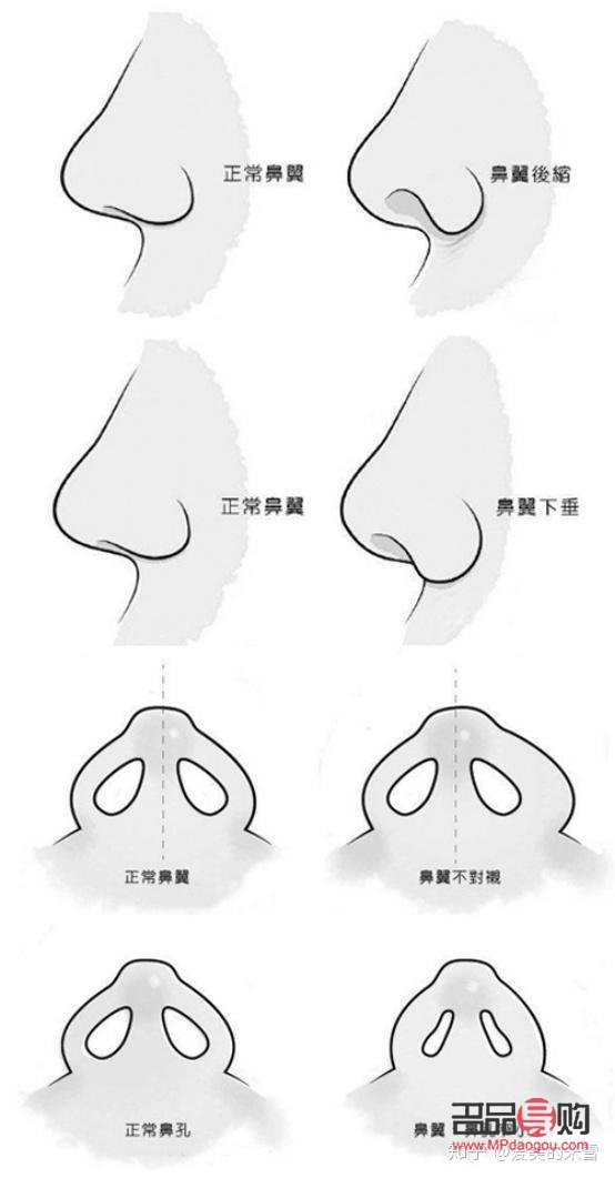 <h3>美容隆鼻价格探究：了解隆鼻手术的费用与价值</h3>