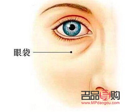 去除眼袋的药膏选择指南