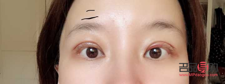 大小眼可以通过双眼皮手术改善吗(大小眼可以通过双眼皮手术改善吗)