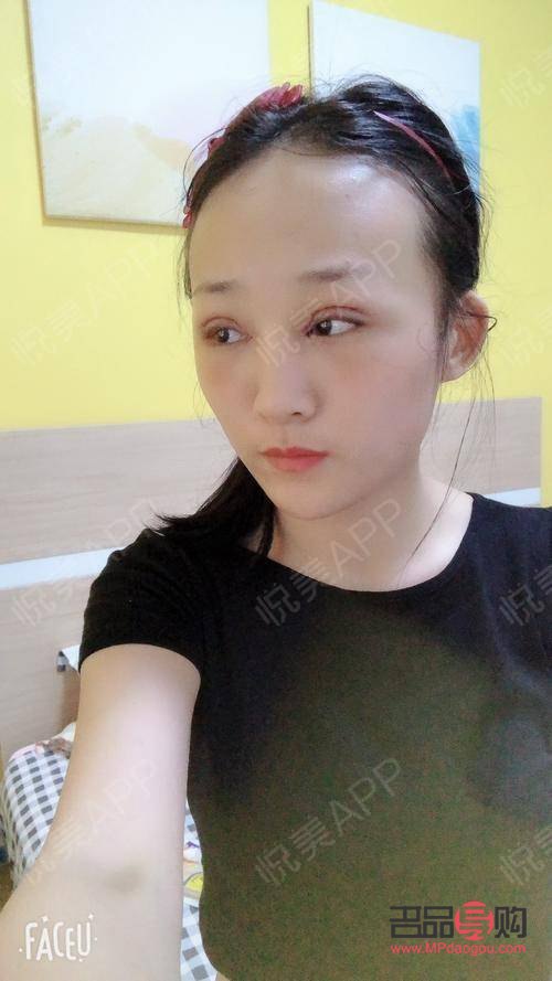 割双眼皮需要多久的时间做完(割双眼皮需要多久的时间做完手术)