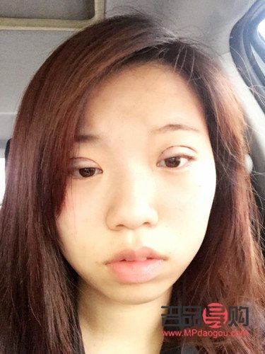 内双能否割双眼皮？专业解答与注意事项