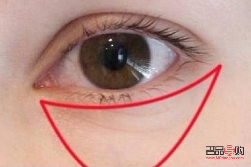 请问眼袋有什么简单方法治疗(请问眼袋有什么简单方法治疗?)