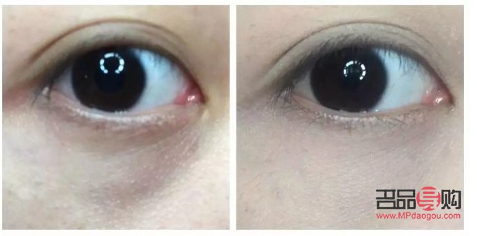 <h3>消除水肿眼霜推荐：告别泡泡眼，重拾明亮神采</h3>