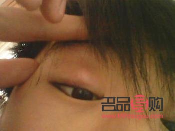 眼皮肿胀怎么消除最快方法(眼皮肿胀怎么消除最快方法图片)