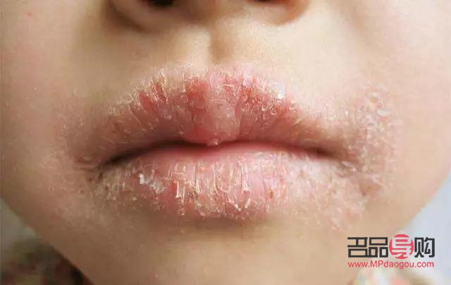 冬天宝宝怎么护理身体(冬天宝宝怎么护理身体最好)