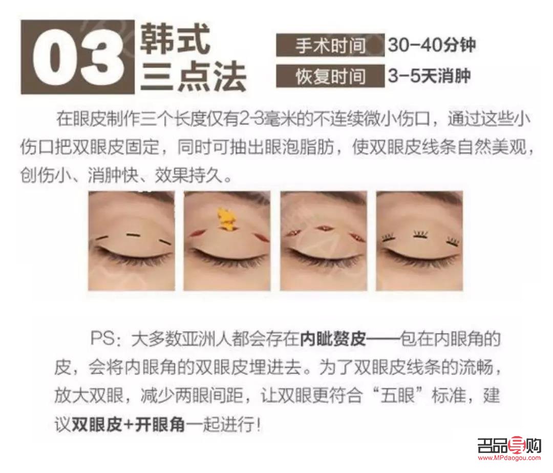 双眼皮自然款是几毫米(双眼皮6mm效果)