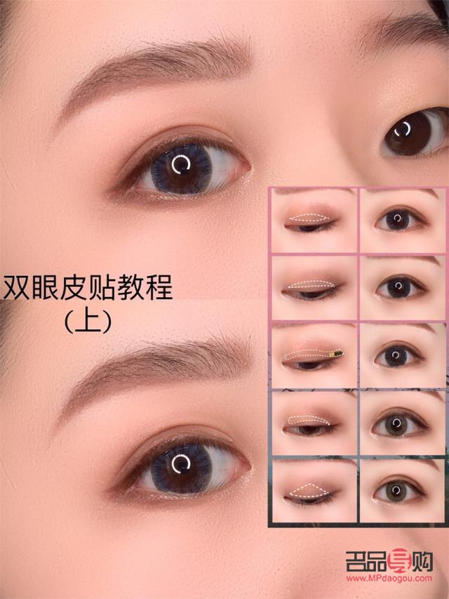 <h3>天生肿泡眼可以消除吗？专业解读与应对方法</h3>