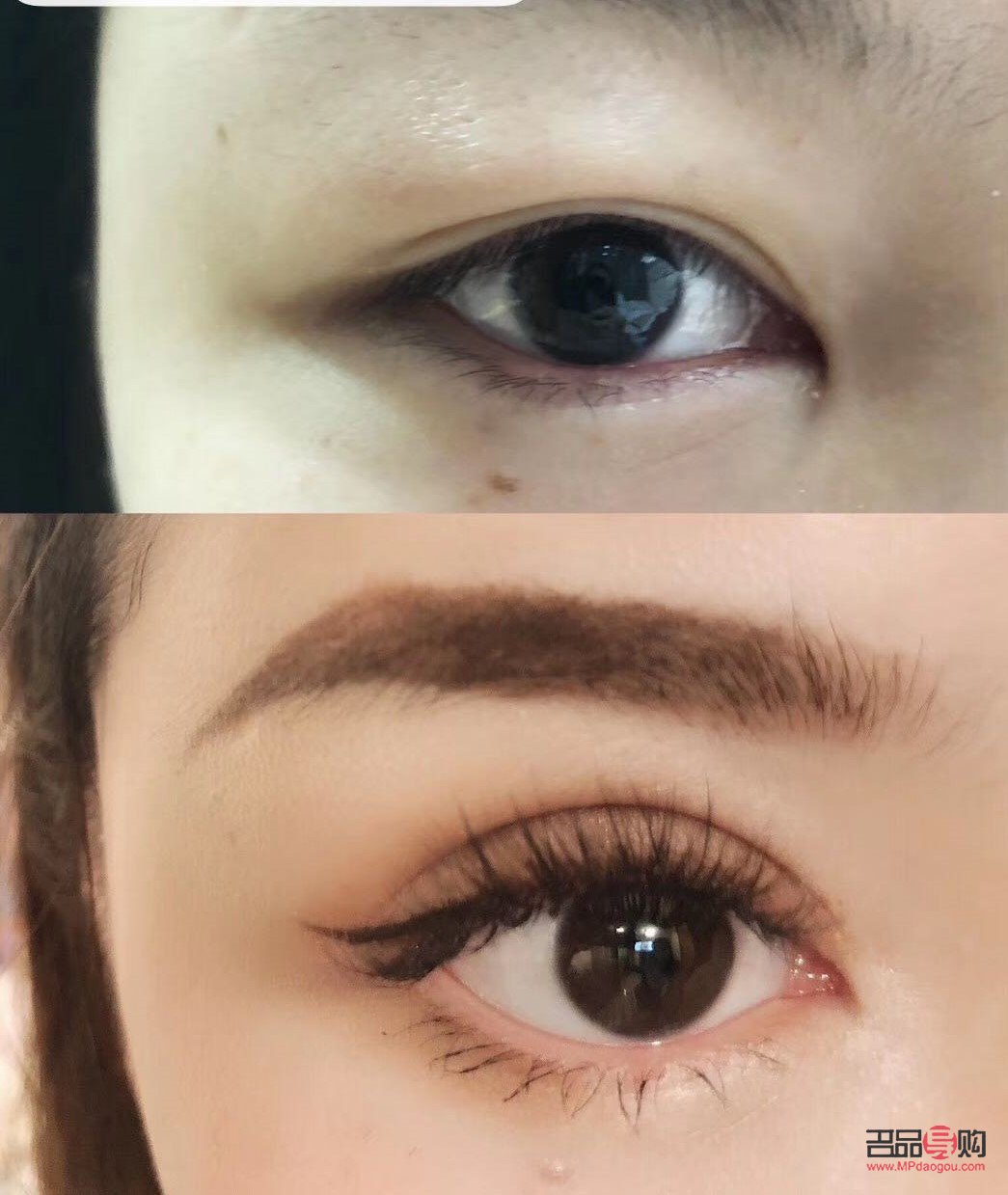 <h3>天生肿泡眼可以消除吗？专业解读与应对方法</h3>