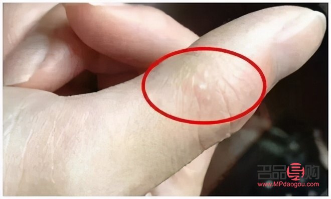 做身体护理怎么会痒(做身体护理怎么会痒痒的)