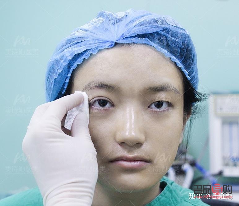 <h3>天生肿眼泡不手术,如何有效改善?</h3> <h3>天生肿眼泡不手术,如何有效改善?</h3>