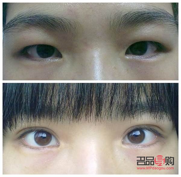 <h3>天生肿眼泡不手术,如何有效改善?</h3> <h3>天生肿眼泡不手术,如何有效改善?</h3>