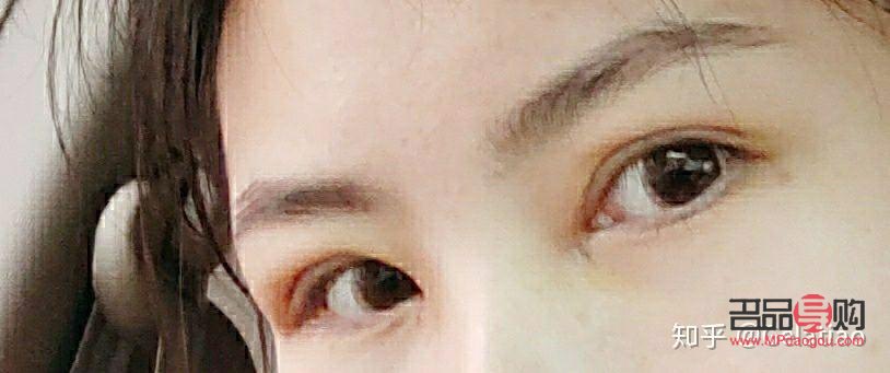 <h3>天生肿眼泡不手术,如何有效改善?</h3> <h3>天生肿眼泡不手术,如何有效改善?</h3>