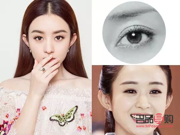 <h3>新月型双眼皮：适合哪些人尝试的眼部美容术</h3>