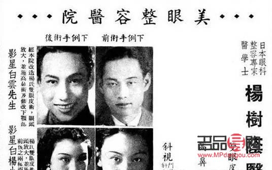 <h3>割双眼皮手术需要多长时间？</h3>