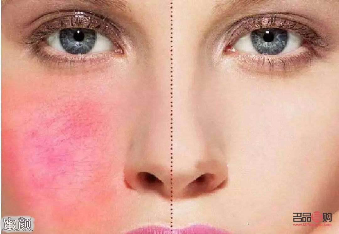 怎么美容去红血丝(怎么美容去红血丝效果好)