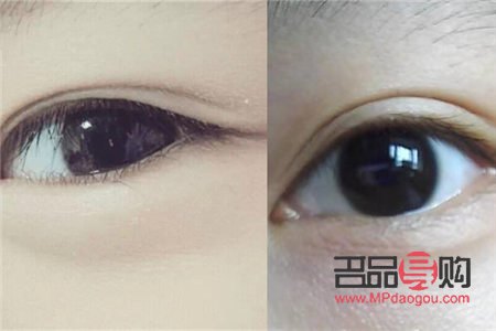 <h3>双眼皮眼型全解析：从魅力杏眼到迷人桃花眼</h3>