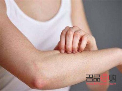 身体发痒怎么办？有效护理方法大揭秘