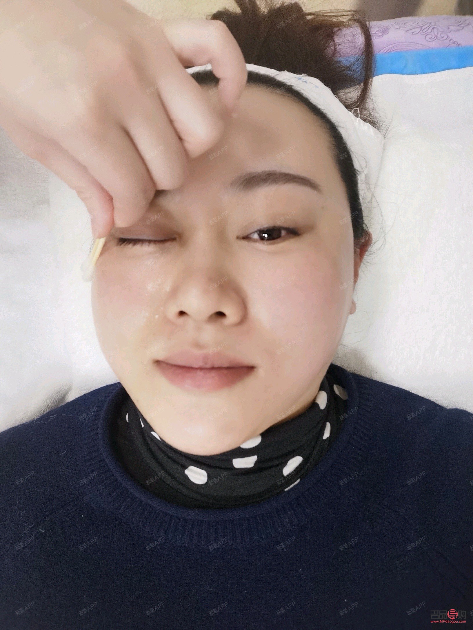 眼部热拉提做后会肿吗(眼部热拉提做后会肿吗) 眼部热拉提做后会肿吗(眼部热拉提做后会肿吗)