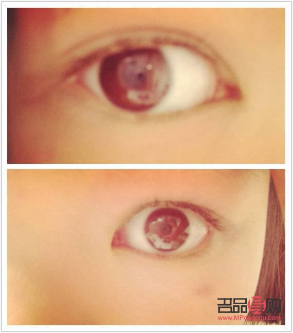 双眼皮大小眼怎么调整图片(双眼皮大小眼怎么调整图片大全)