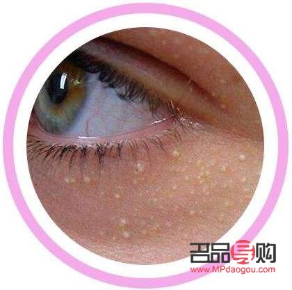 眼部衰老怎么修复最好(眼部衰老怎么修复最好的方法)