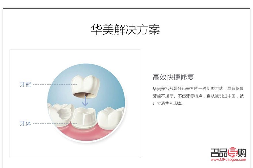 美容冠危害深度解析