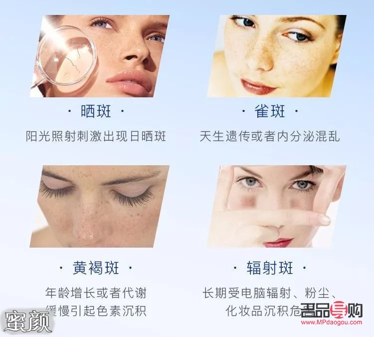 激光美容祛斑好吗(激光美容祛斑好吗多少钱)