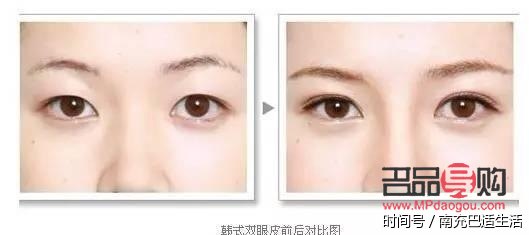 双眼皮有几种眼型照片图片女(双眼皮有几种眼型照片图片女生)