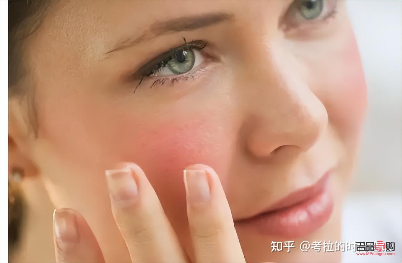 脸红美容吗(脸红能修复好吗)