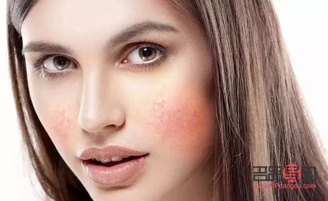 脸红美容吗(脸红能修复好吗)