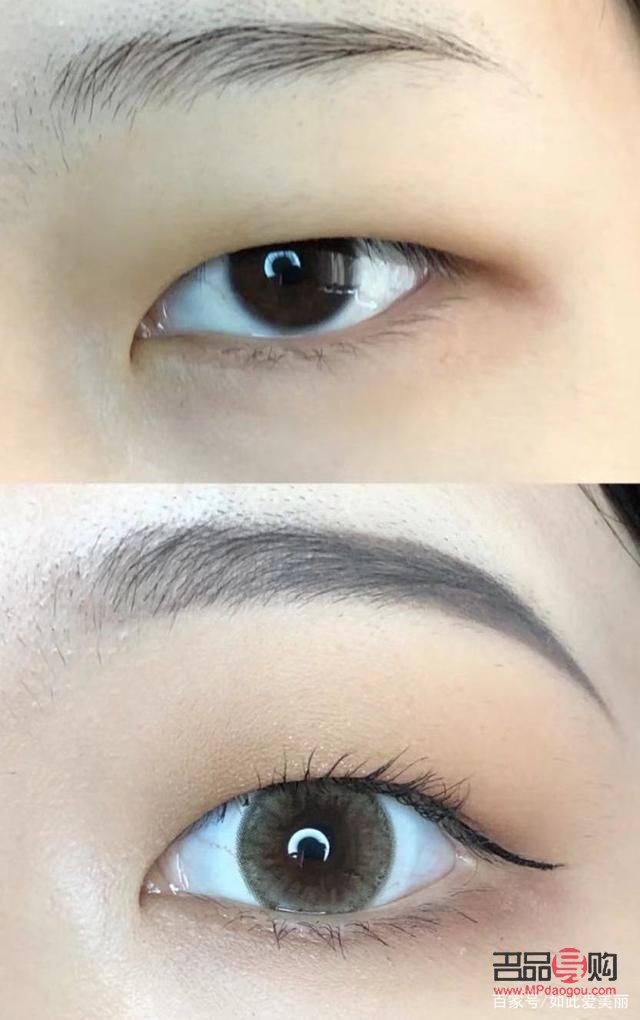 肿眼泡怎么改善(单眼皮肿眼泡怎么改善)