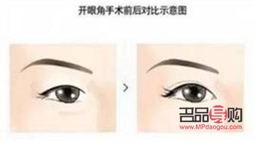 开眼角与不开眼角的区别(开眼角与不开眼角的区别图)