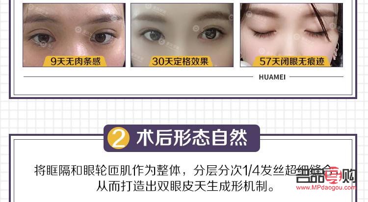 翘睫双眼皮是永久的吗怎么做(翘睫双眼皮是永久的吗怎么做手术)