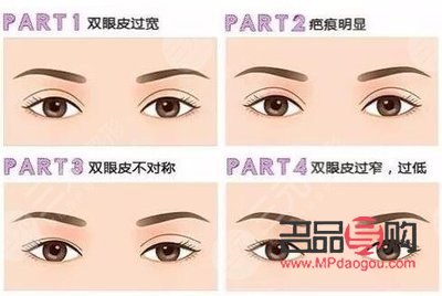 双眼皮：宽与窄，哪一种更具魅力？