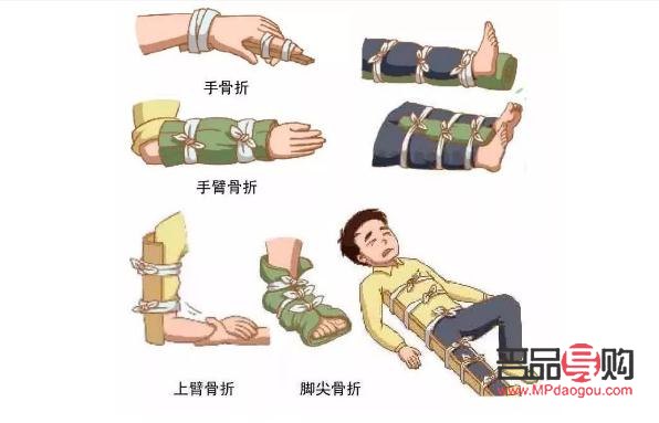 <h3>骨折后如何科学护理身体</h3>