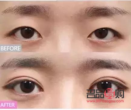 5种双眼皮型(几种双眼皮的眼型)