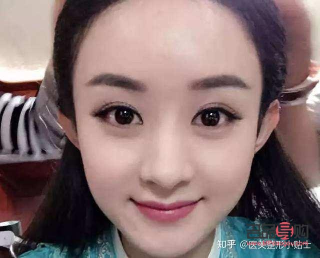 新月型双眼皮真人图片女孩(新月型双眼皮真人图片女孩可爱)