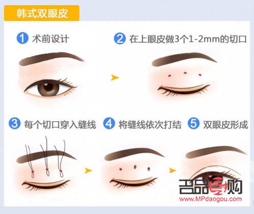 全切双眼皮款式全解析：打造迷人电眼的秘密武器