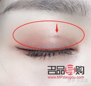 双眼皮有三条线 是什么原因(双眼皮有三条线 是什么原因造成的)