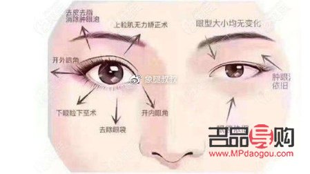 小眼综合四项都包括什么(小眼综合四项都包括什么内容)