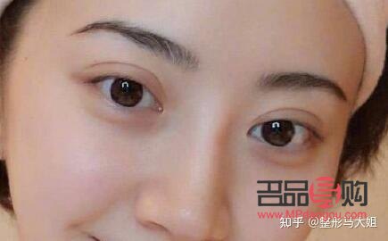 全切双眼皮宽修窄(全切双眼皮宽修窄还是窄)